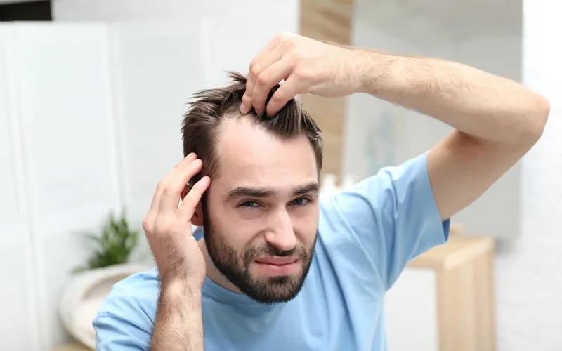 Hair Loss
